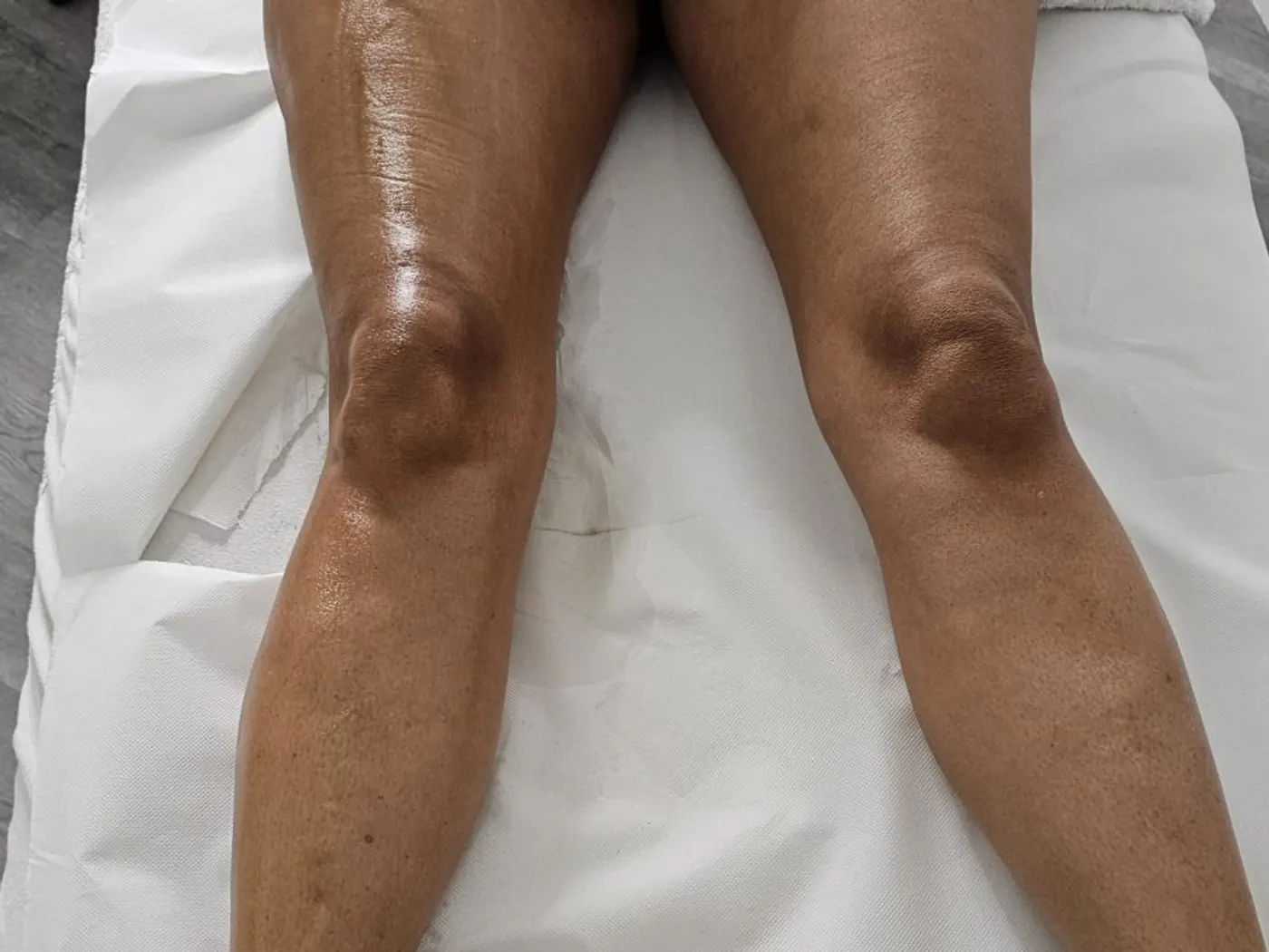 Jambes posées sur le drap d'examen de la table de soin, en lumière de plafonnier